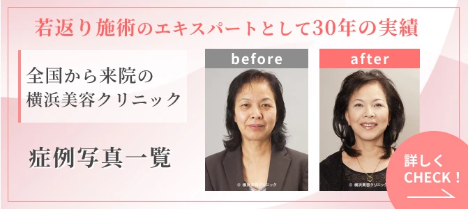 若返り施術のエキスパートとして30年の実績。全国から来院の横浜美容クリニック。症例写真をくわしくチェック！