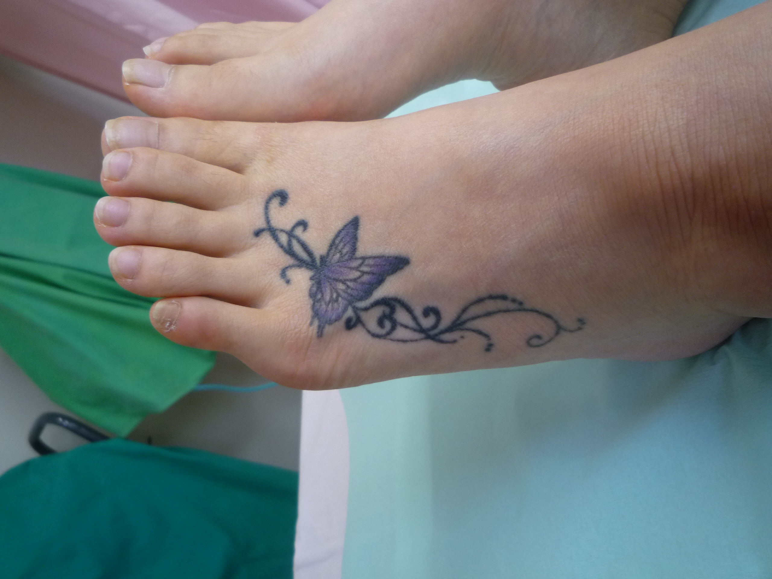 刺青を取りたい 足首 足の甲２ 画像あり 横浜で働く美容外科院長の美容整形ここだけの話ブログ