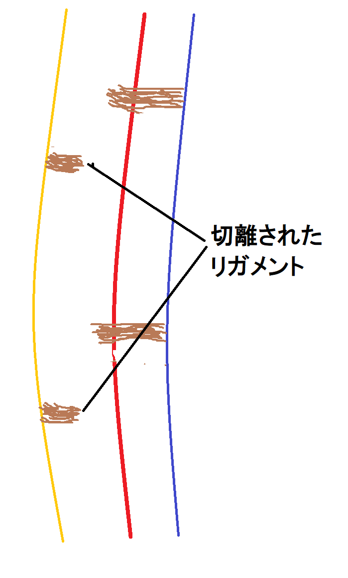 フェイスリフトとリガメント 画像あり 横浜で働く美容外科院長の美容整形ここだけの話ブログ